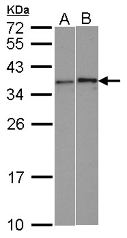 Anti-WBSCR22 Antibody