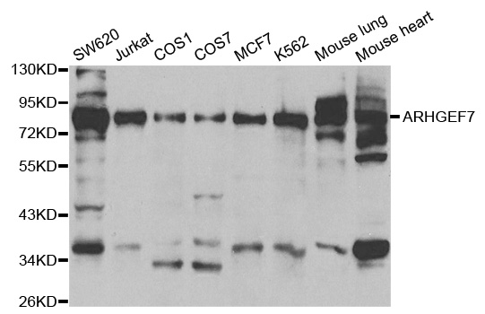 Anti-ARHGEF7 Antibody