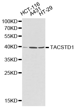 Anti-TACSTD1 Antibody