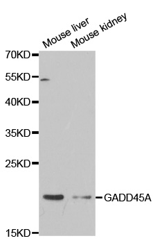 Anti-GADD45A Antibody