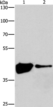 Anti-MAPK11 Antibody