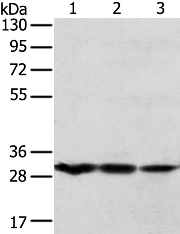 Anti-TPD52L2 Antibody