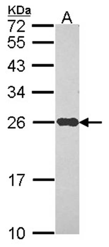 Anti-NDUFS8 Antibody