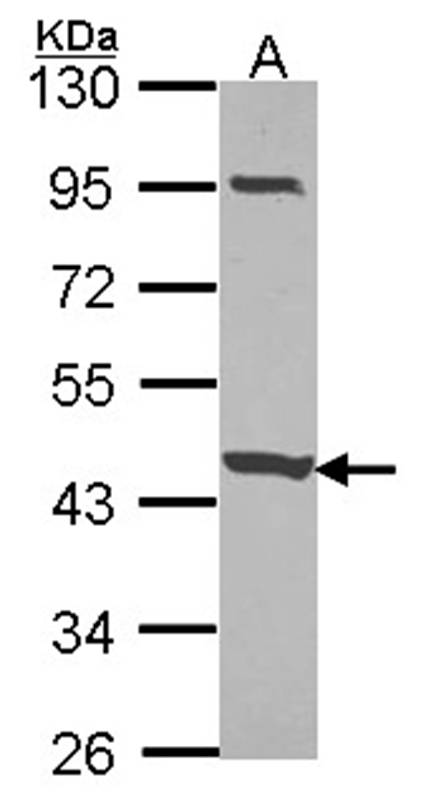 Anti-CCDC83 Antibody