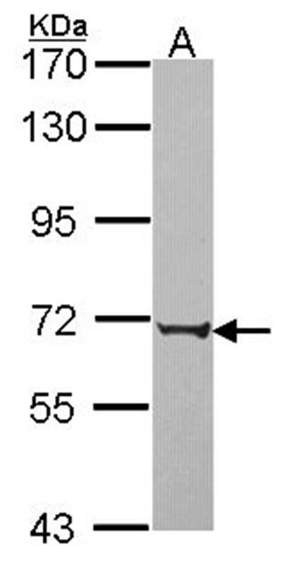 Anti-PABPC3 Antibody