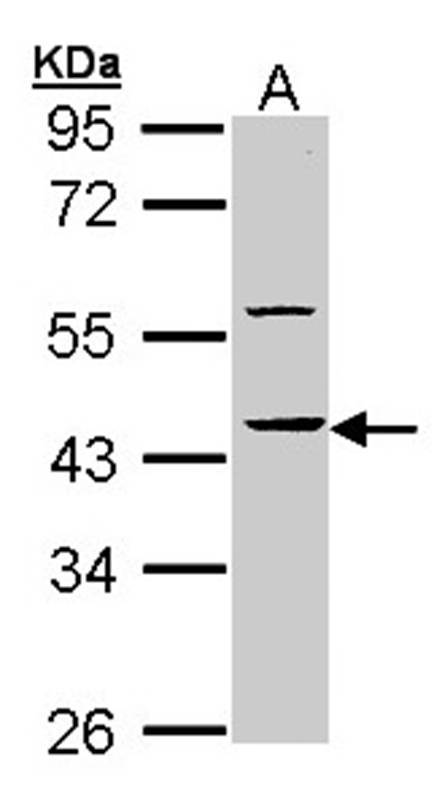 Anti-HS1BP3 Antibody