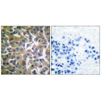 Anti-FAP-1 Antibody