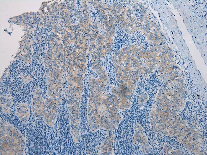 Anti-CLDN25 Antibody