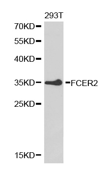 Anti-FCER2 Antibody