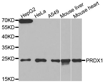 Anti-PRDX1 Antibody