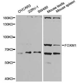 Anti-FOXM1 Antibody