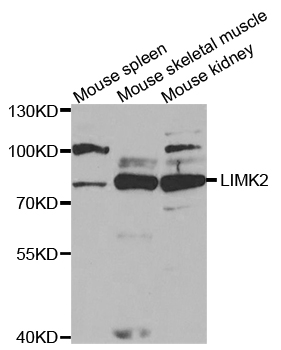 Anti-LIMK2 Antibody