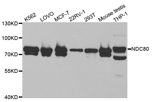 Anti-NDC80 Antibody