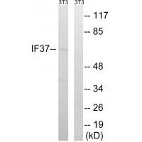 Anti-EIF3D Antibody