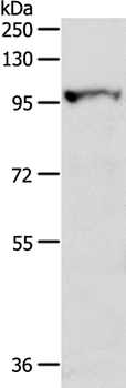 Anti-MGEA5 Antibody