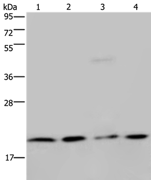 Anti-MCTS1 Antibody