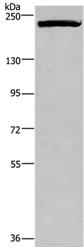 Anti-PRDM2 Antibody