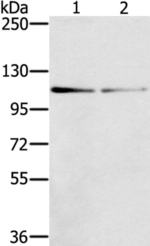 Anti-DSTYK Antibody