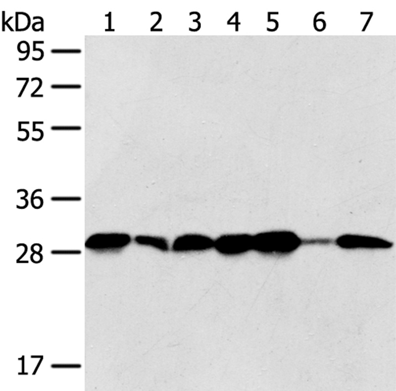 Anti-SRPRB Antibody