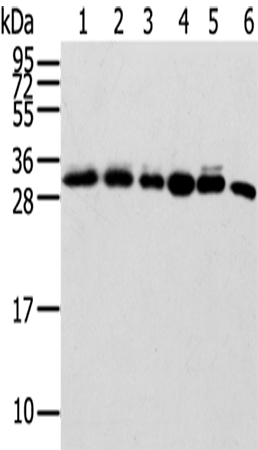 Anti-SENP8 Antibody