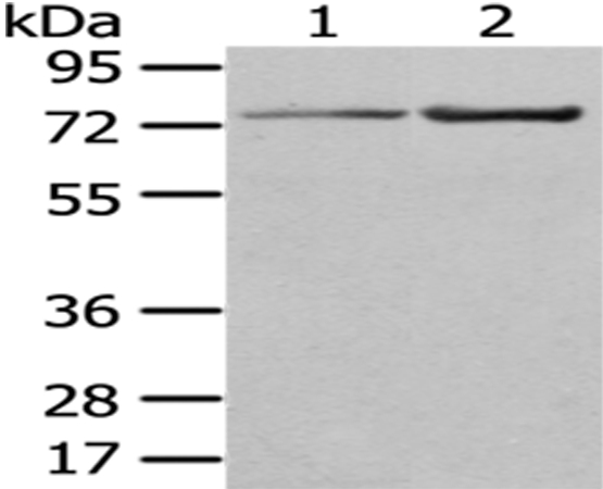 Anti-MASP1 Antibody