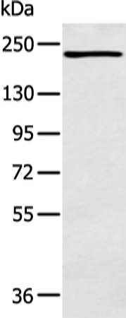 Anti-NCOR2 Antibody