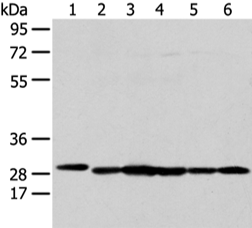 Anti-PRDX4 Antibody