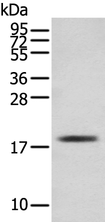 Anti-TNNC1 Antibody