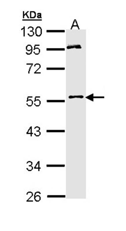 Anti-MPP1 Antibody