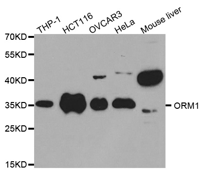 Anti-ORM1 Antibody