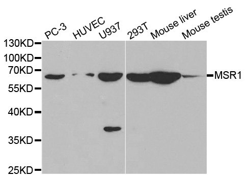 Anti-MSR1 Antibody