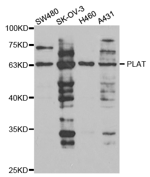 Anti-PLAT Antibody