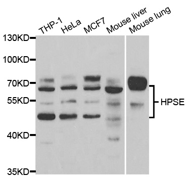 Anti-HPSE Antibody