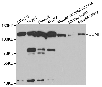 Anti-COMP Antibody