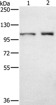 Anti-ODF2 Antibody