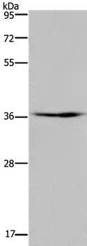 Anti-PIM3 Antibody