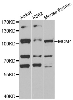 Anti-MCM4 Antibody