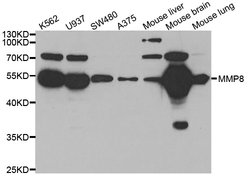 Anti-MMP8 Antibody