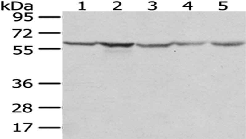 Anti-TCP1 Antibody