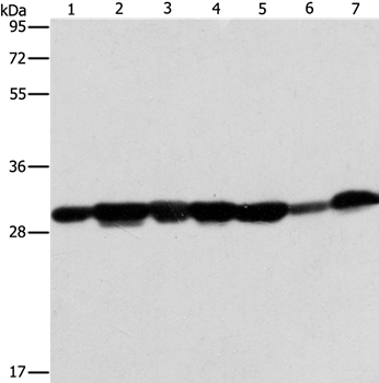 Anti-AK2 Antibody