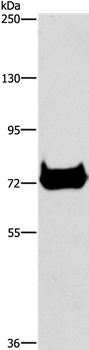 Anti-CEL Antibody