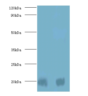 Anti-Protein DJ-1 Antibody