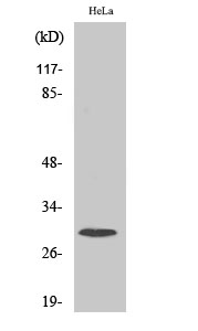 Anti-Ribosomal Protein S4X Antibody