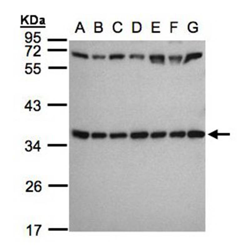 Anti-ribosomal protein S3a Antibody