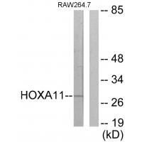 Anti-HOXA11 / D11 Antibody