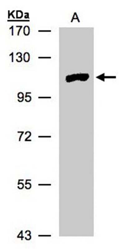 Anti-myotubularin related protein 4 Antibody