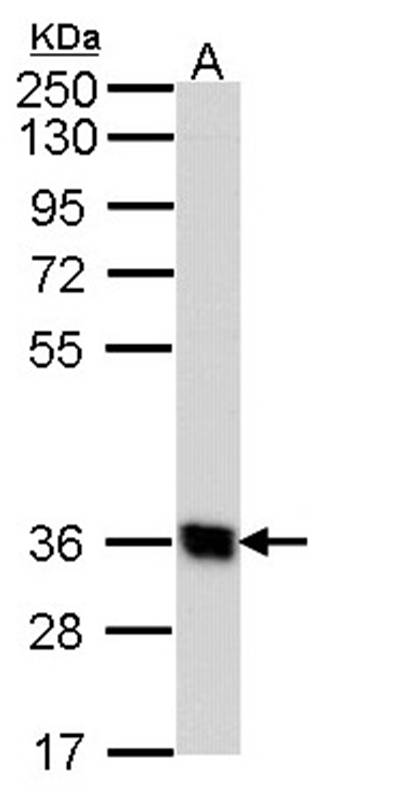 Anti-G protein-coupled receptor 62 Antibody