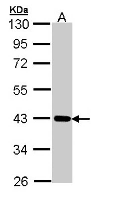 Anti-Cartilage-associated protein Antibody