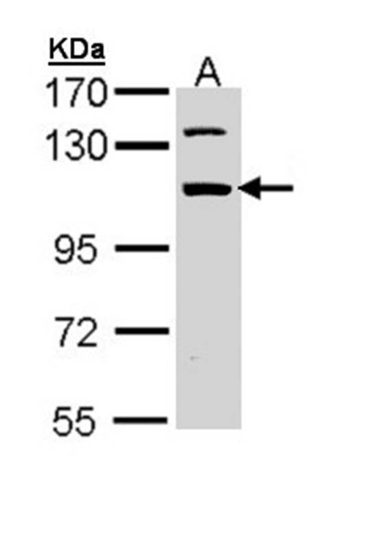 Anti-RNA binding motif protein 28 Antibody