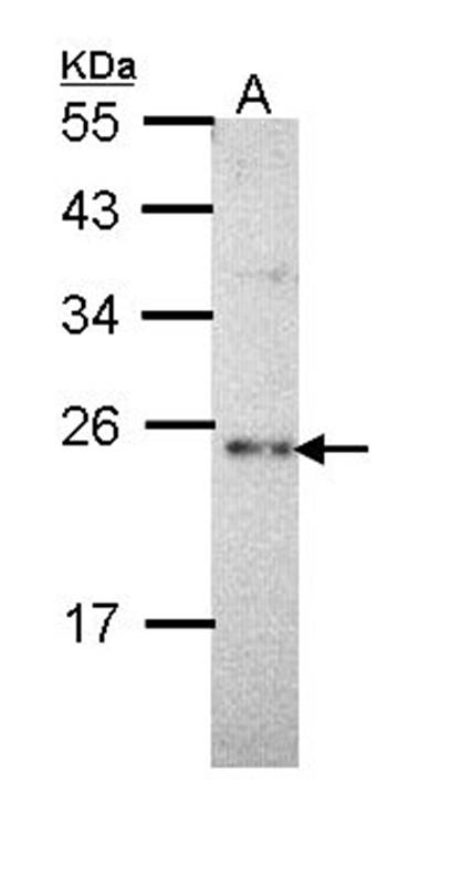 Anti-calcium binding protein P22 Antibody